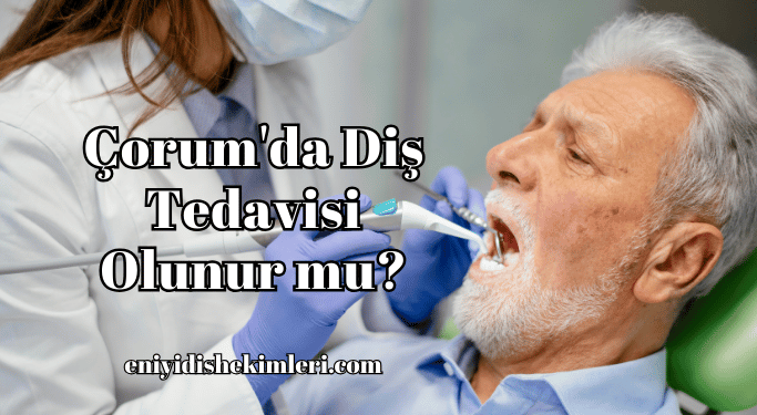 Çorum'da Diş Tedavisi Olunur mu?