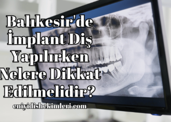 Balıkesir'de İmplant Diş Yapılırken Nelere Dikkat Edilmelidir?