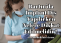 Bartın'da İmplant Diş Yapılırken Nelere Dikkat Edilmelidir?