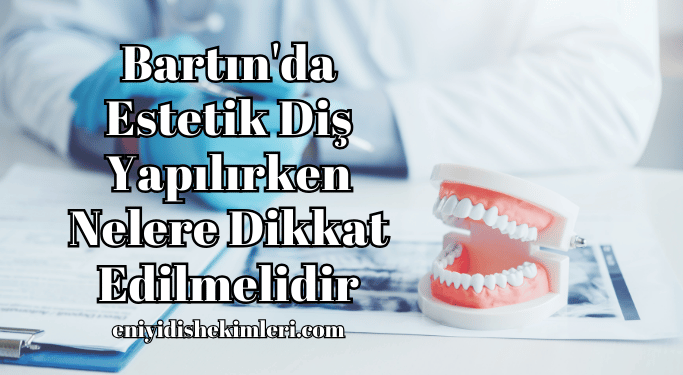 Bartın'da Estetik Diş Yapılırken Nelere Dikkat Edilmelidir
