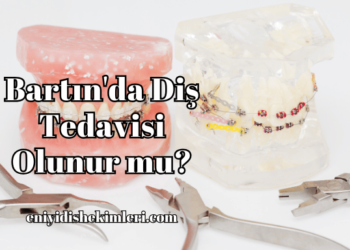 Bartın'da Diş Tedavisi Olunur mu?