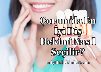 Çorum'da En İyi Diş Hekimi Nasıl Seçilir?