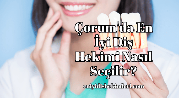 Çorum'da En İyi Diş Hekimi Nasıl Seçilir?