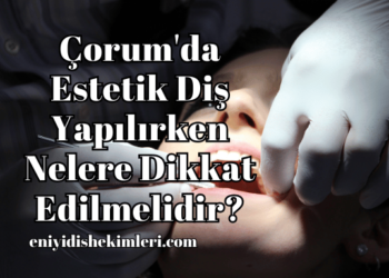 Çorum'da Estetik Diş Yapılırken Nelere Dikkat Edilmelidir?