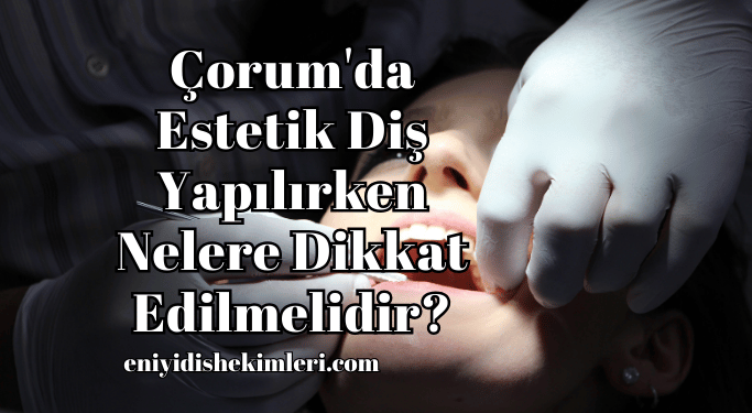 Çorum'da Estetik Diş Yapılırken Nelere Dikkat Edilmelidir?