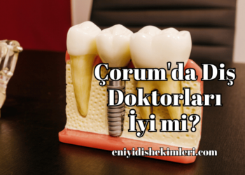 Çorum'da Diş Doktorları İyi mi?