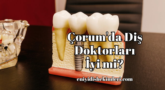 Çorum'da Diş Doktorları İyi mi?