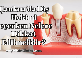 Çankırı'da Diş Hekimi Seçerken Nelere Dikkat Edilmelidir?