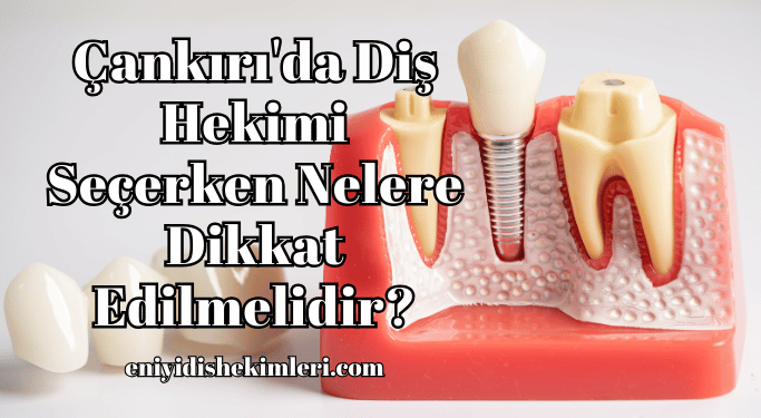 Çankırı'da Diş Hekimi Seçerken Nelere Dikkat Edilmelidir?