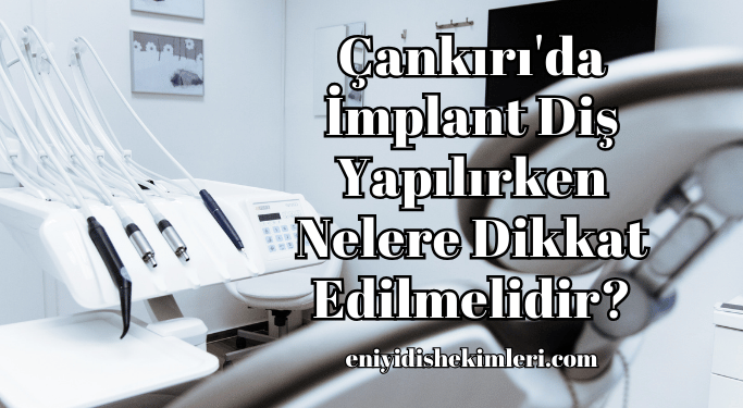 Çankırı'da İmplant Diş Yapılırken Nelere Dikkat Edilmelidir?