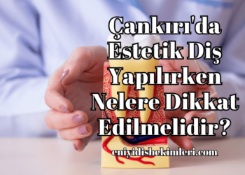 Çankırı'da Estetik Diş Yapılırken Nelere Dikkat Edilmelidir?