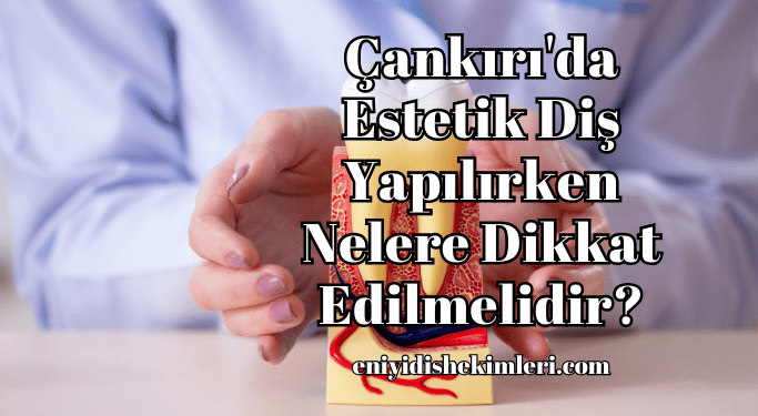 Çankırı'da Estetik Diş Yapılırken Nelere Dikkat Edilmelidir?