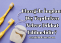 Elazığ'da İmplant Diş Yapılırken Nelere Dikkat Edilmelidir?