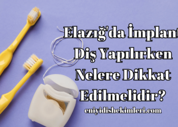 Elazığ'da İmplant Diş Yapılırken Nelere Dikkat Edilmelidir?