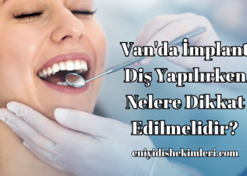 Van'da İmplant Diş Yapılırken Nelere Dikkat Edilmelidir?