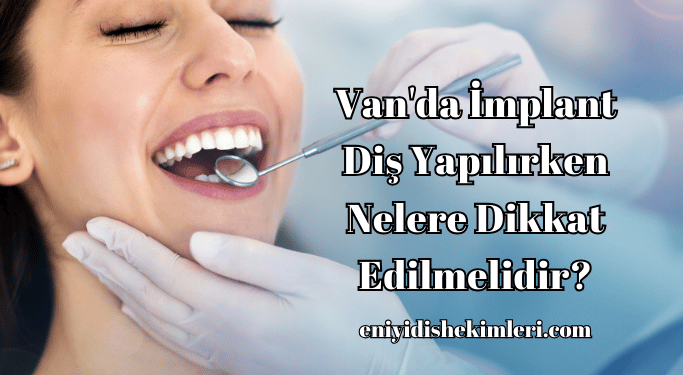 Van'da İmplant Diş Yapılırken Nelere Dikkat Edilmelidir?