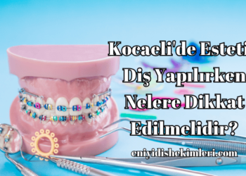 Kocaeli'de Estetik Diş Yapılırken Nelere Dikkat Edilmelidir?