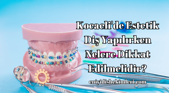 Kocaeli'de Estetik Diş Yapılırken Nelere Dikkat Edilmelidir?