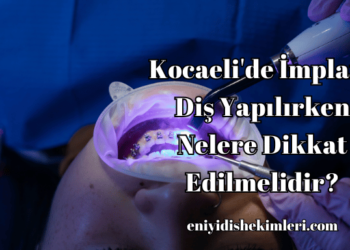 Kocaeli'de İmplant Diş Yapılırken Nelere Dikkat Edilmelidir?
