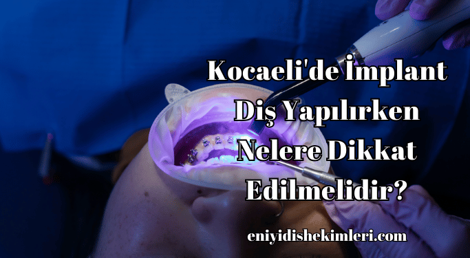 Kocaeli'de İmplant Diş Yapılırken Nelere Dikkat Edilmelidir?
