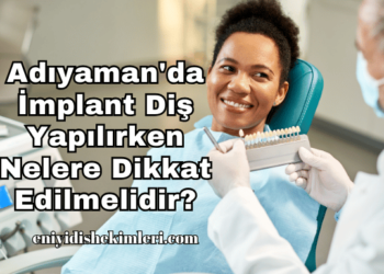 Adıyaman'da İmplant Diş Yapılırken Nelere Dikkat Edilmelidir?
