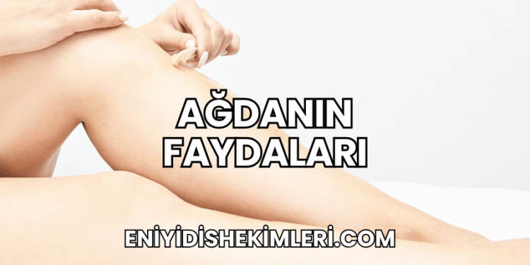 Ağdanın Faydaları