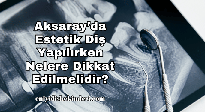 Aksaray’da Estetik Diş Yapılırken Nelere Dikkat Edilmelidir?