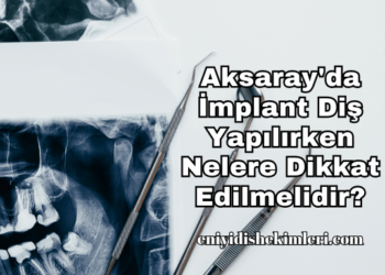 Aksaray'da İmplant Diş Yapılırken Nelere Dikkat Edilmelidir?