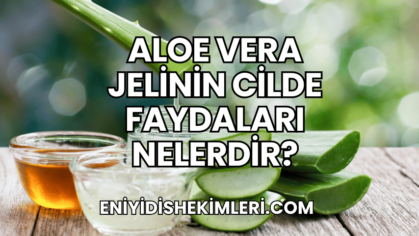 Aloe Vera Jelinin Cilde Faydaları Nelerdir?