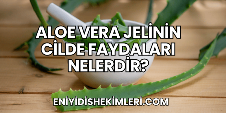 Aloe Vera Jelinin Cilde Faydaları Nelerdir?