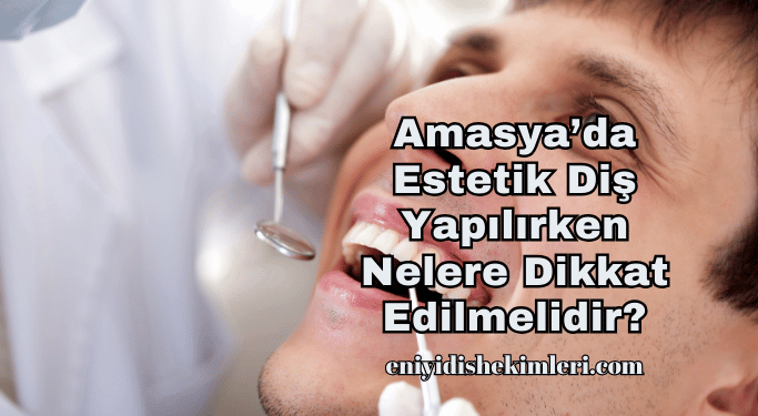 Amasya’da Estetik Diş Yapılırken Nelere Dikkat Edilmelidir?
