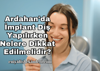 Ardahan'da İmplant Diş Yapılırken Nelere Dikkat Edilmelidir?
