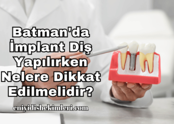 Batman'da İmplant Diş Yapılırken Nelere Dikkat Edilmelidir?
