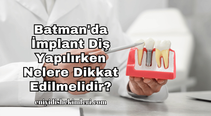 Batman'da İmplant Diş Yapılırken Nelere Dikkat Edilmelidir?