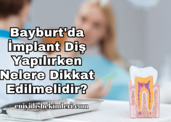 Bayburt'da İmplant Diş Yapılırken Nelere Dikkat Edilmelidir?