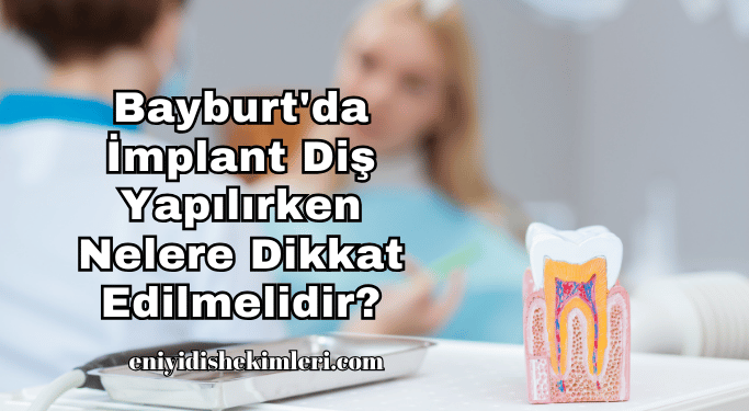 Bayburt'da İmplant Diş Yapılırken Nelere Dikkat Edilmelidir?