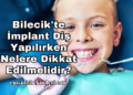 Bilecik'te İmplant Diş Yapılırken Nelere Dikkat Edilmelidir?