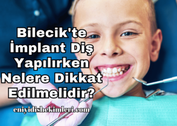 Bilecik'te İmplant Diş Yapılırken Nelere Dikkat Edilmelidir?
