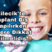 Bilecik'te İmplant Diş Yapılırken Nelere Dikkat Edilmelidir?