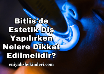 Bitlis'de Estetik Diş Yapılırken Nelere Dikkat Edilmelidir?