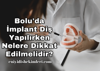 Bolu'da İmplant Diş Yapılırken Nelere Dikkat Edilmelidir?