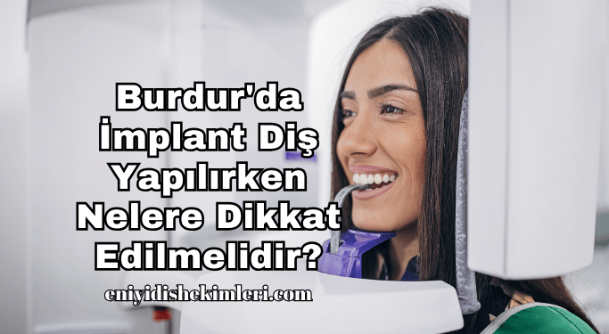 Burdur'da İmplant Diş Yapılırken Nelere Dikkat Edilmelidir?