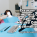 Erzurum'da İmplant Diş Yapılırken Nelere Dikkat Edilmelidir?