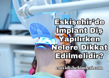 Eskişehir'de İmplant Diş Yapılırken Nelere Dikkat Edilmelidir?
