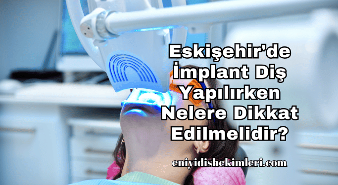 Eskişehir'de İmplant Diş Yapılırken Nelere Dikkat Edilmelidir?