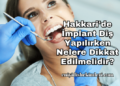Hakkari'de İmplant Diş Yapılırken Nelere Dikkat Edilmelidir?