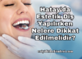 Hatay'da Estetik Diş Yapılırken Nelere Dikkat Edilmelidir?