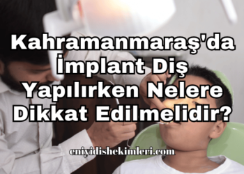Kahramanmaraş'da İmplant Diş Yapılırken Nelere Dikkat Edilmelidir?