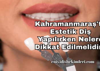 Kahramanmaraş'ta Estetik Diş Yapılırken Nelere Dikkat Edilmelidir?