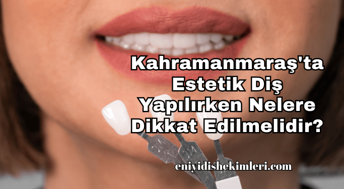 Kahramanmaraş'ta Estetik Diş Yapılırken Nelere Dikkat Edilmelidir?